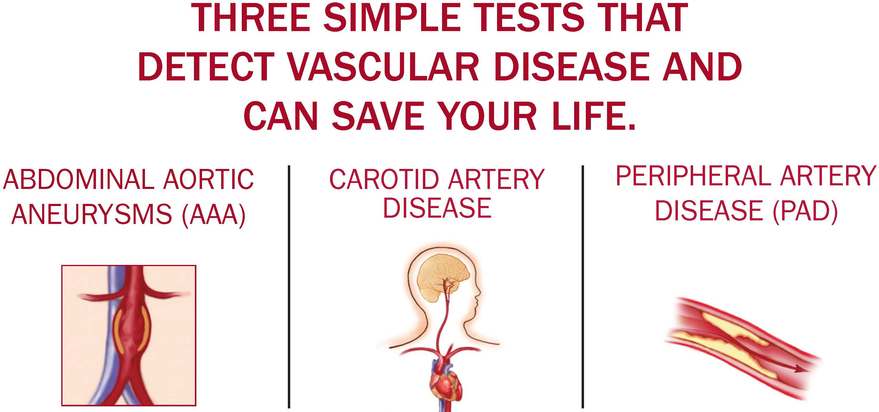 free-vascular-disease-screening-on-saturday-september-22-three-quick